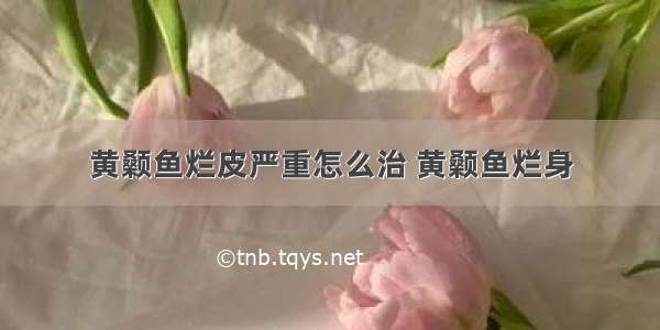 黄颡鱼烂皮严重怎么治 黄颡鱼烂身