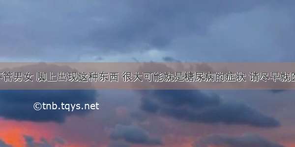 不管男女 脚上出现这种东西 很大可能就是糖尿病的症状 请尽早就医！