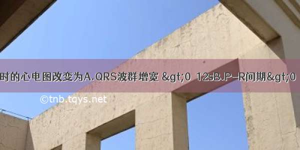 Ⅰ度房室传导阻滞时的心电图改变为A.QRS波群增宽 >0．12sB.P-R间期>0．12sC.P-R间期D