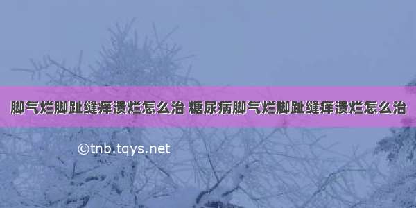 脚气烂脚趾缝痒溃烂怎么治 糖尿病脚气烂脚趾缝痒溃烂怎么治