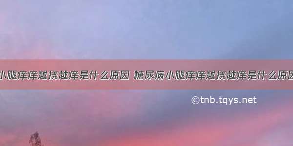 小腿痒痒越挠越痒是什么原因 糖尿病小腿痒痒越挠越痒是什么原因