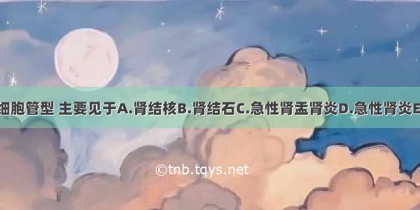 尿中出现红细胞管型 主要见于A.肾结核B.肾结石C.急性肾盂肾炎D.急性肾炎E.慢性肾盂肾