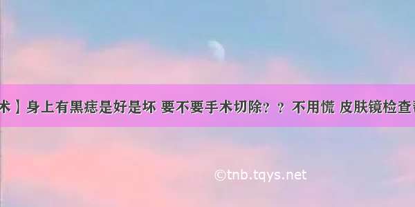 【技术】身上有黑痣是好是坏 要不要手术切除？？不用慌 皮肤镜检查帮你忙