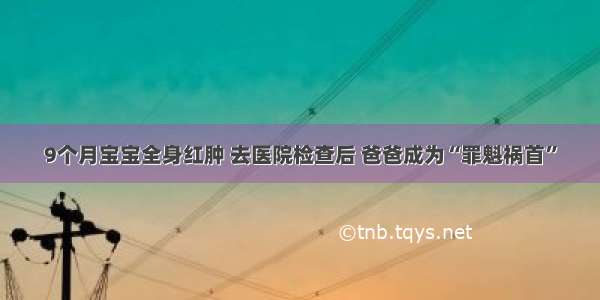 9个月宝宝全身红肿 去医院检查后 爸爸成为“罪魁祸首”