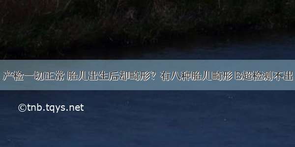 产检一切正常 胎儿出生后却畸形？有八种胎儿畸形 B超检测不出