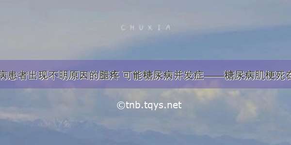 糖尿病患者出现不明原因的腿疼 可能糖尿病并发症——糖尿病肌梗死在作祟