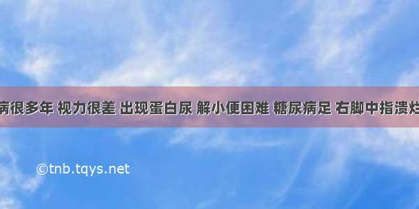 得糖尿病很多年 视力很差 出现蛋白尿 解小便困难 糖尿病足 右脚中指溃烂 脚背和