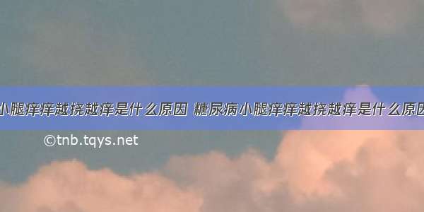 小腿痒痒越挠越痒是什么原因 糖尿病小腿痒痒越挠越痒是什么原因