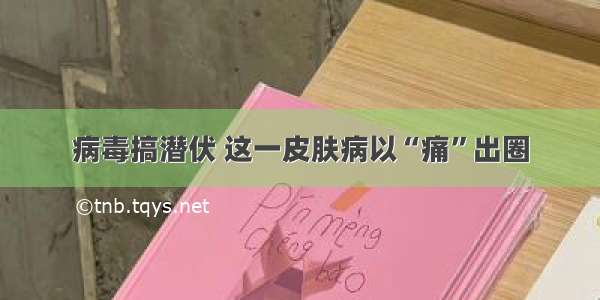 病毒搞潜伏 这一皮肤病以“痛”出圈