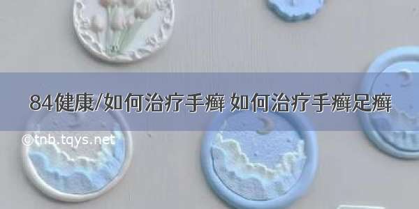 84健康/如何治疗手癣 如何治疗手癣足癣