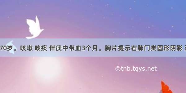 患者 男 70岁。咳嗽 咳痰 伴痰中带血3个月。胸片提示右肺门类圆形阴影 边缘毛躁