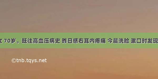 患者 女 70岁。既往高血压病史 昨日感右耳内疼痛 今晨洗脸 漱口时发现右口角