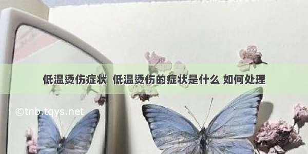 低温烫伤症状  低温烫伤的症状是什么 如何处理