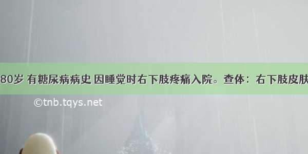 患者男 80岁 有糖尿病病史 因睡觉时右下肢疼痛入院。查体：右下肢皮肤苍白 足