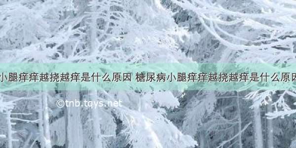 小腿痒痒越挠越痒是什么原因 糖尿病小腿痒痒越挠越痒是什么原因