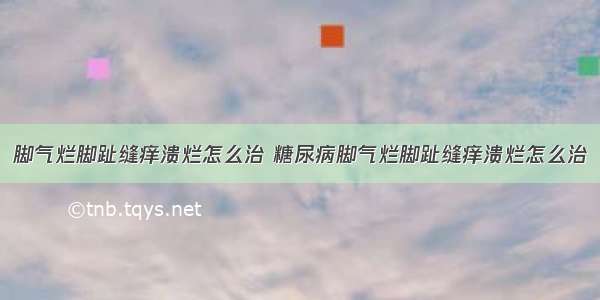 脚气烂脚趾缝痒溃烂怎么治 糖尿病脚气烂脚趾缝痒溃烂怎么治