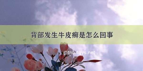 背部发生牛皮癣是怎么回事