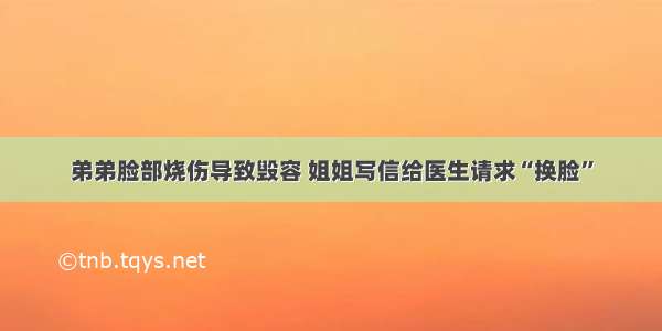 弟弟脸部烧伤导致毁容 姐姐写信给医生请求“换脸”