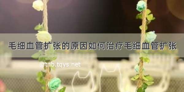 毛细血管扩张的原因如何治疗毛细血管扩张