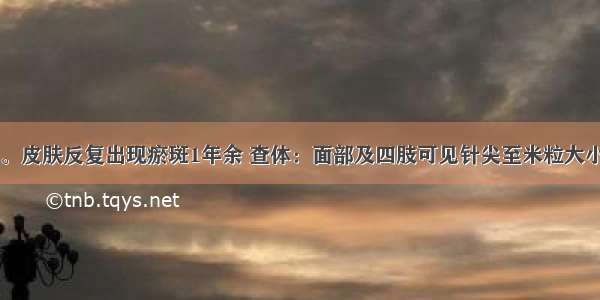 患儿 10岁。皮肤反复出现瘀斑1年余 查体：面部及四肢可见针尖至米粒大小红色皮疹 