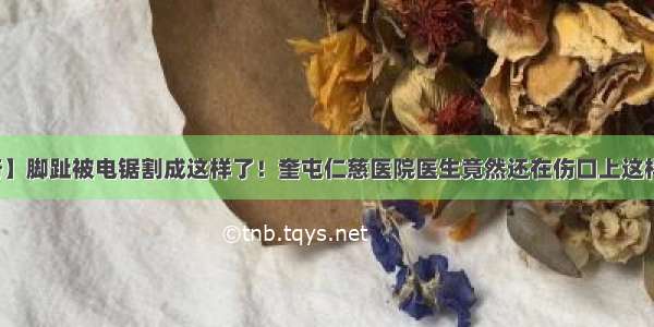 【神奇】脚趾被电锯割成这样了！奎屯仁慈医院医生竟然还在伤口上这样做......