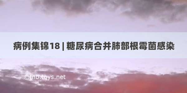 病例集锦18 | 糖尿病合并肺部根霉菌感染