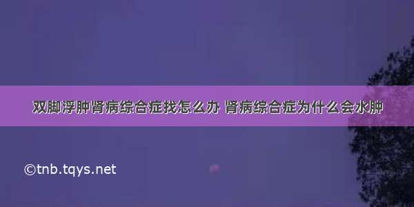 双脚浮肿肾病综合症找怎么办 肾病综合症为什么会水肿