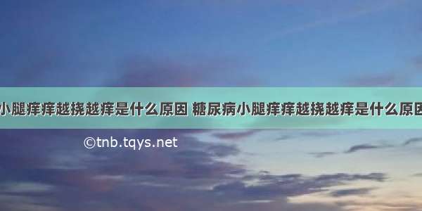 小腿痒痒越挠越痒是什么原因 糖尿病小腿痒痒越挠越痒是什么原因