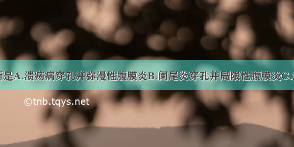 最可能的诊断是A.溃疡病穿孔并弥漫性腹膜炎B.阑尾炎穿孔并局限性腹膜炎C.急性出血坏死