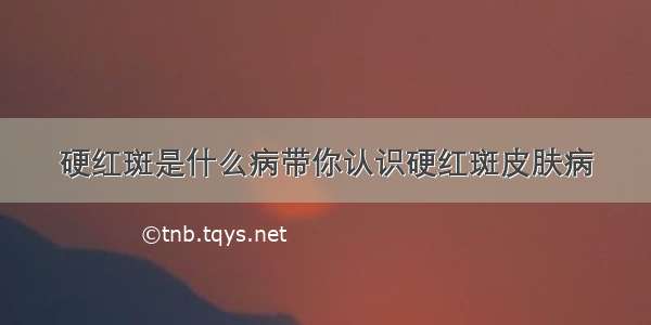 硬红斑是什么病带你认识硬红斑皮肤病