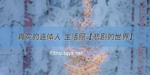 真实的连体人 生活照【悲剧的世界】