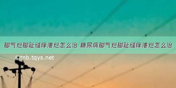 脚气烂脚趾缝痒溃烂怎么治 糖尿病脚气烂脚趾缝痒溃烂怎么治