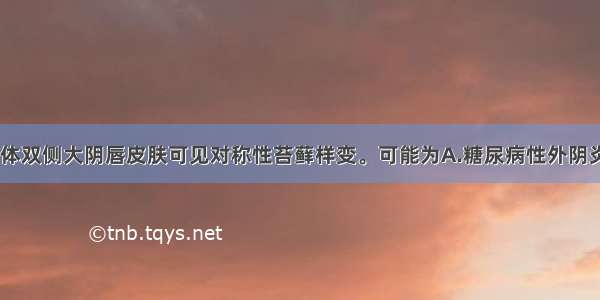 外阴瘙痒 查体双侧大阴唇皮肤可见对称性苔藓样变。可能为A.糖尿病性外阴炎B.白化病C.