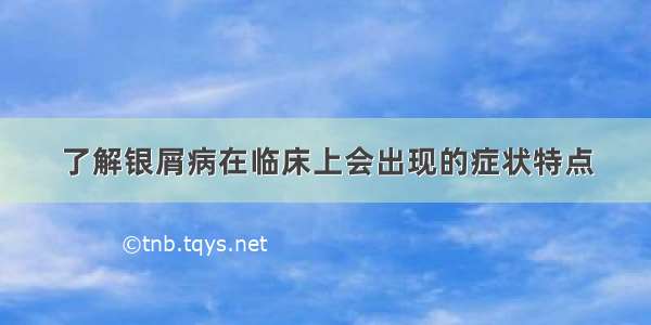 了解银屑病在临床上会出现的症状特点