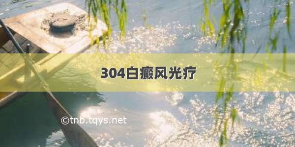 304白癜风光疗