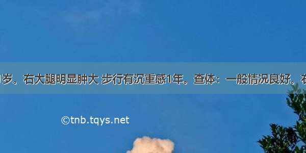 女性 21岁。右大腿明显肿大 步行有沉重感1年。查体：一般情况良好。右大腿中