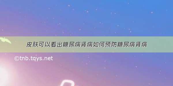 皮肤可以看出糖尿病肾病如何预防糖尿病肾病