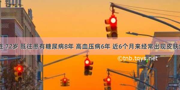 患者 男性 72岁 既往患有糖尿病8年 高血压病6年 近6个月来经常出现皮肤烧灼感及