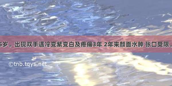 患者 女 45岁。出现双手遇冷变紫变白及疼痛3年 2年来颜面水肿 张口受限。查体：血