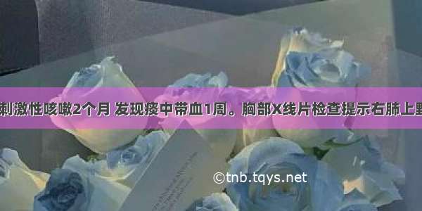 男 68岁。刺激性咳嗽2个月 发现痰中带血1周。胸部X线片检查提示右肺上野团块影 大