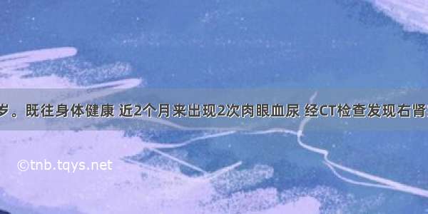 患者男 55岁。既往身体健康 近2个月来出现2次肉眼血尿 经CT检查发现右肾实质及右肾