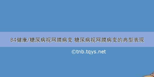 84健康/糖尿病视网膜病变 糖尿病视网膜病变的典型表现