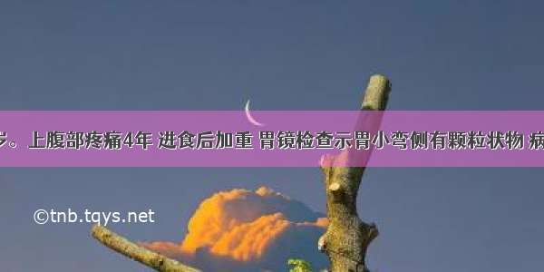 女性 60岁。上腹部疼痛4年 进食后加重 胃镜检查示胃小弯侧有颗粒状物 病理示重度