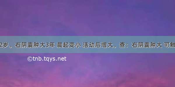 患者男 12岁。右阴囊肿大3年 晨起变小 活动后增大。查：右阴囊肿大 可触及囊性感