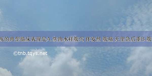 细菌性痢疾的典型临床表现是A.洗肉水样腹泻 伴发热 腹痛 无里急后重B.腹泻 黏液脓