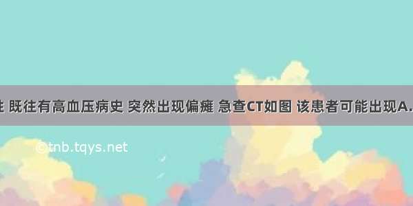 患者 男性 既往有高血压病史 突然出现偏瘫 急查CT如图 该患者可能出现A.左侧肢体