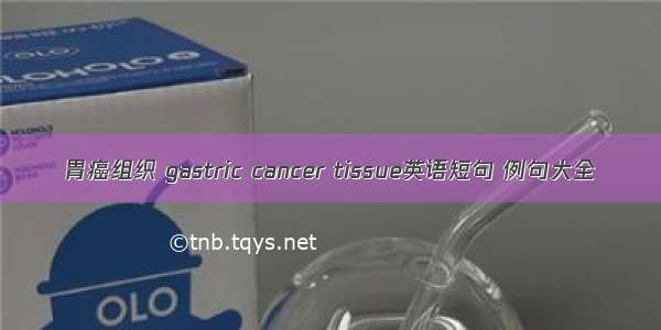 胃癌组织 gastric cancer tissue英语短句 例句大全