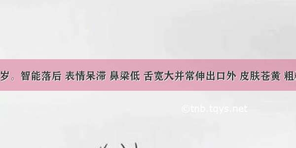 患儿 1岁。智能落后 表情呆滞 鼻梁低 舌宽大并常伸出口外 皮肤苍黄 粗糙 四肢