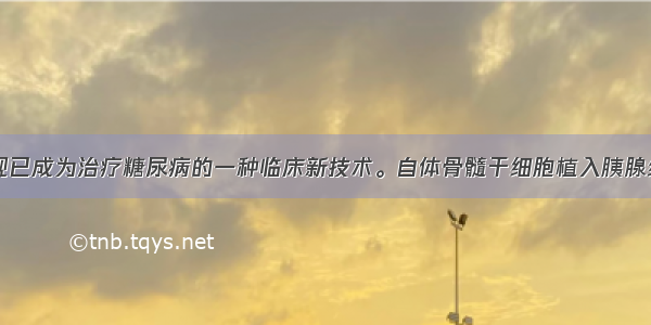 干细胞移植现已成为治疗糖尿病的一种临床新技术。自体骨髓干细胞植入胰腺组织后可分化