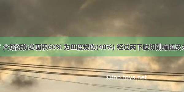 女性 40岁 火焰烧伤总面积60% 为Ⅲ度烧伤(40%) 经过两下肢切削痂植皮术后1天 术